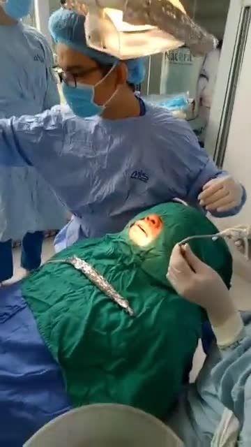 cấy ghép Implant răng 36 tại nha khoa Smile One