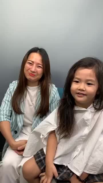 Mũi sau nâng 1 tháng vào form ổn định, không có dấu hiệu sưng bầm