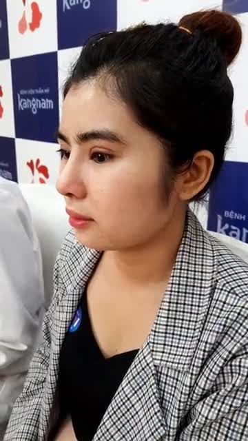 Mũi cao thôi chưa đủ Sống mũi gọn đẹp mới càng cuốn hút