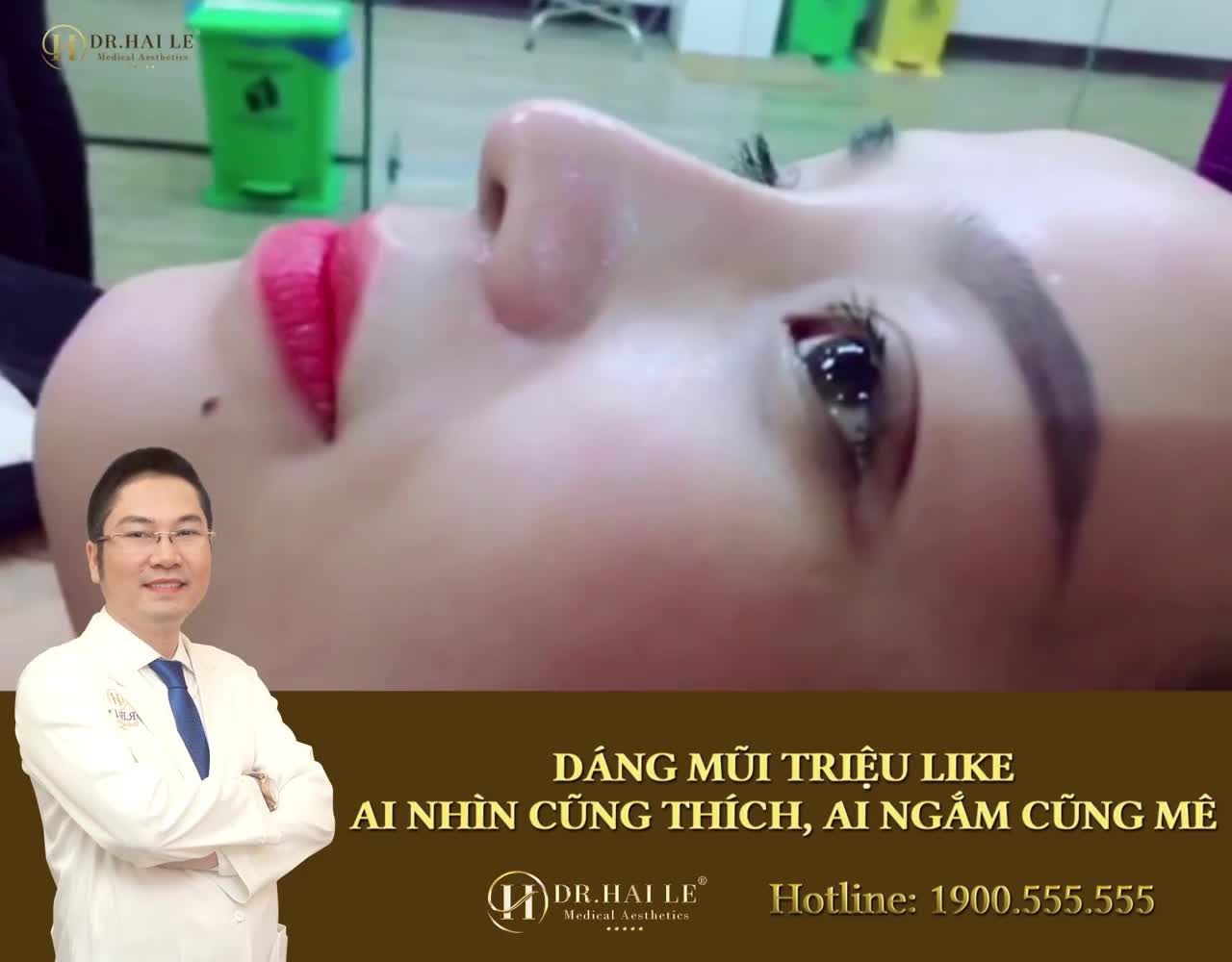 Cùng chiêm ngưỡng dáng mũi sau 10 ngày NÂNG MŨI DEMI 5D đẹp mê mẩn, say đắm lòng người ạ!