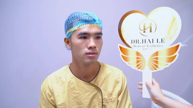 Cắt mí nam giới đẹp chuẩn nam tính chỉ có tại Dr.Hải Lê.!