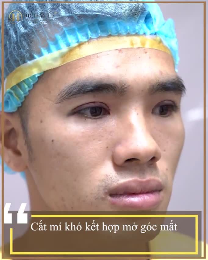 Nắng đã có Mũ, Mưa đã có Ô CẮT MÍ KHÓ đã có DR.HẢI LÊ.!!