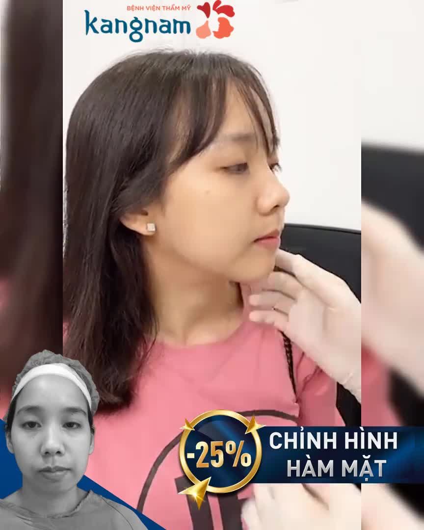 Pha giải cứu "mặt lệch" quá ngoạn mục nhờ combo GỌT HÀM + TRƯỢT CẰM