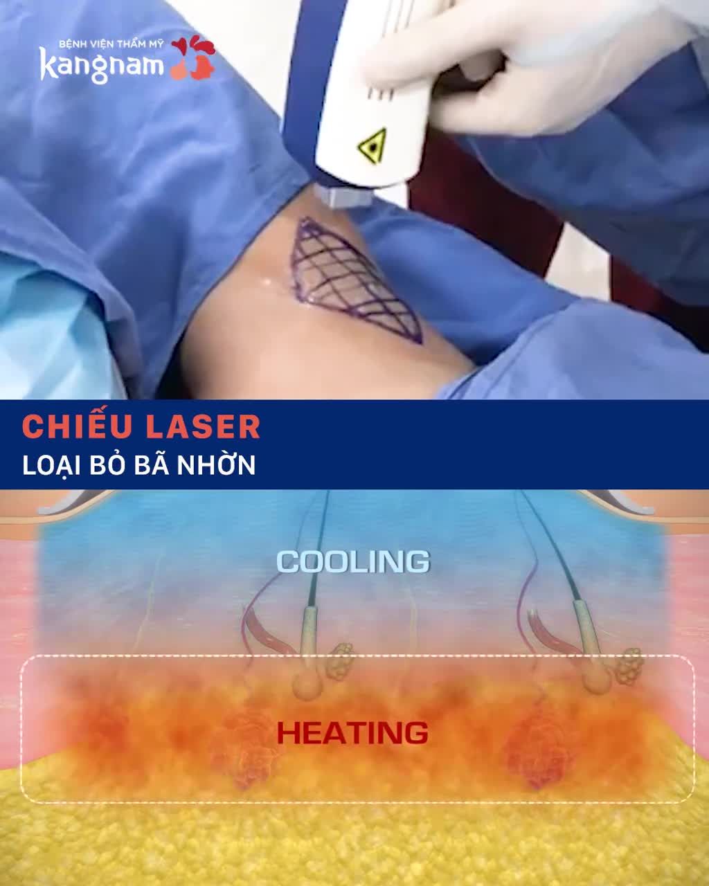 Mùi HÔI NÁCH đeo bám mấy chục năm bay sạch sau 1 giờ