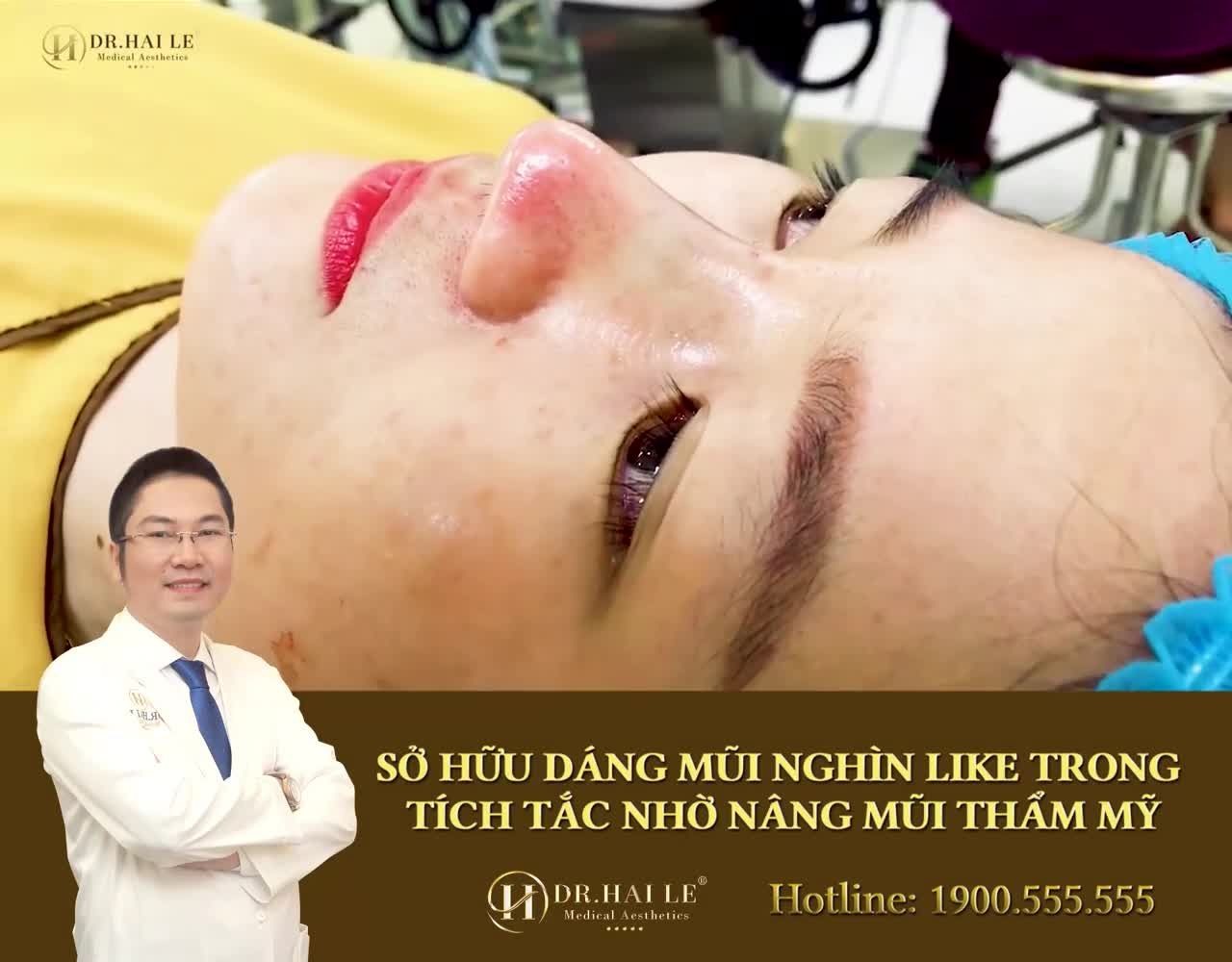 NÂNG MŨI CỰC XINH "RINH" QUÀ CỰC KHỦNG