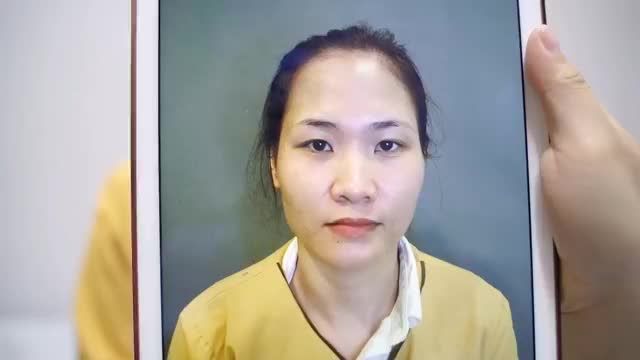 Combo nâng Mũi + Cắt mí giúp bạn thay đổi nhan sắc như thế nào?