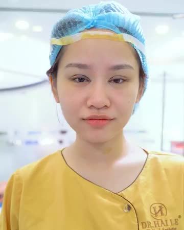 Mí lót + gốc mắt quá căng xử lý như thế nào? Theo dõi video để có câu trả lời bạn nhé.!