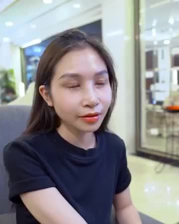 TIẾP TỤC CA KHÁCH HÀNG COMBO NÂNG MŨI + CẮT MÍ SAU 10 NGÀY đẹp mê ly cho cả nhà cùng chiêm ngưỡng!
