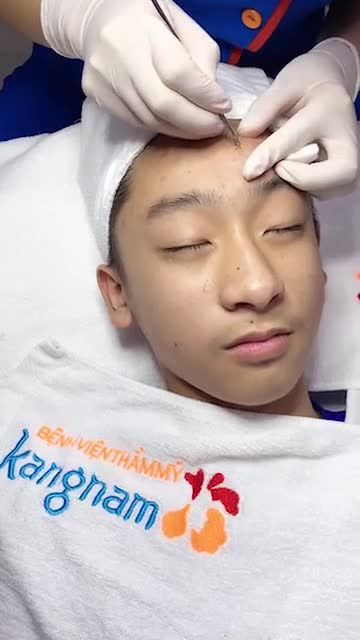 Điều trị mụn với Công nghệ Nano skin - quét bay mụn trong vòng 1 nốt nhạc.