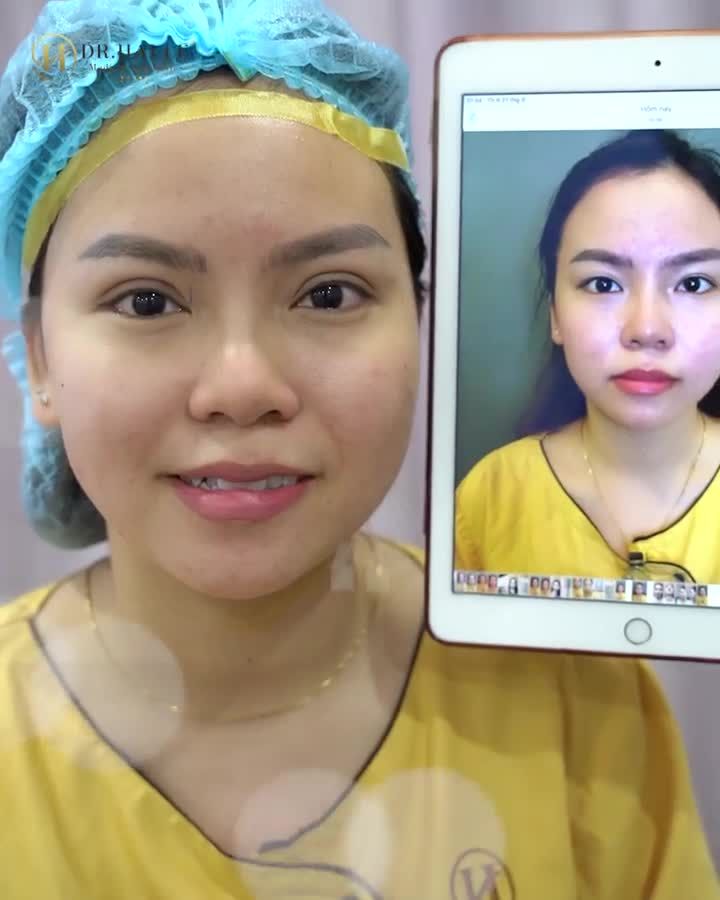 CẮT MÍ ĐẸP XINH – CHI PHÍ CỰC HỜI - BẮT TRỌN ƯU TẠI DR.HẢI LÊ‼️