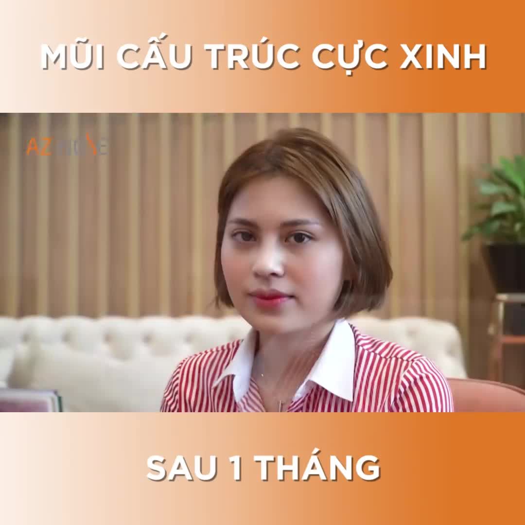 FORM MŨI CẤU TRÚC CỰC XINH của bạn Hoàng Linh - Nhân viên ngân hàng tại HCM
