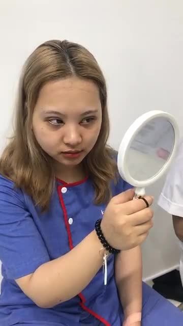 Ca CẮT MÍ thứ 39 trong ngày tại Kangnam Hà Nội