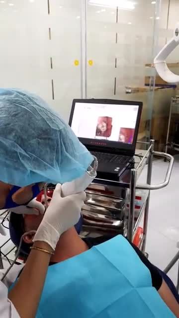 Lấy dấu mẫu hàm bằng công nghệ Scan 3D trước khi phẫu thuật chỉnh hình hàm mặt Bấm xem ngay