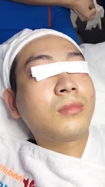 Loại bỏ độc tố cho làn da. da sáng, sạch sâu sau liệu trình chỉ 4 buổi trị liệU Trải nghiệm ngay