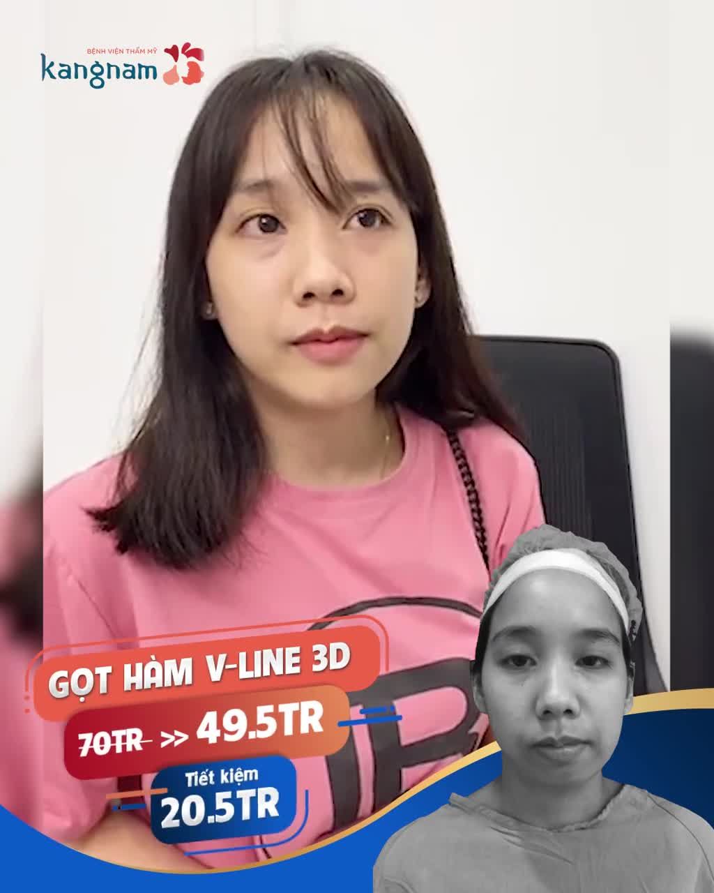 Cập nhật nhanh nhất chi phí + ưu đãi "lột xác" diện mạo với bảng giá thẩm mỹ hàm mặt siêu hot