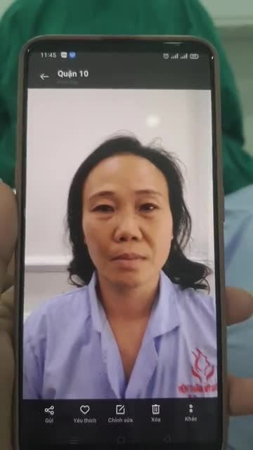 BÁC SĨ VỪA THỰC HIỆN XONG CA NÂNG MŨI CẤU TRÚC TỰ NHIÊN
