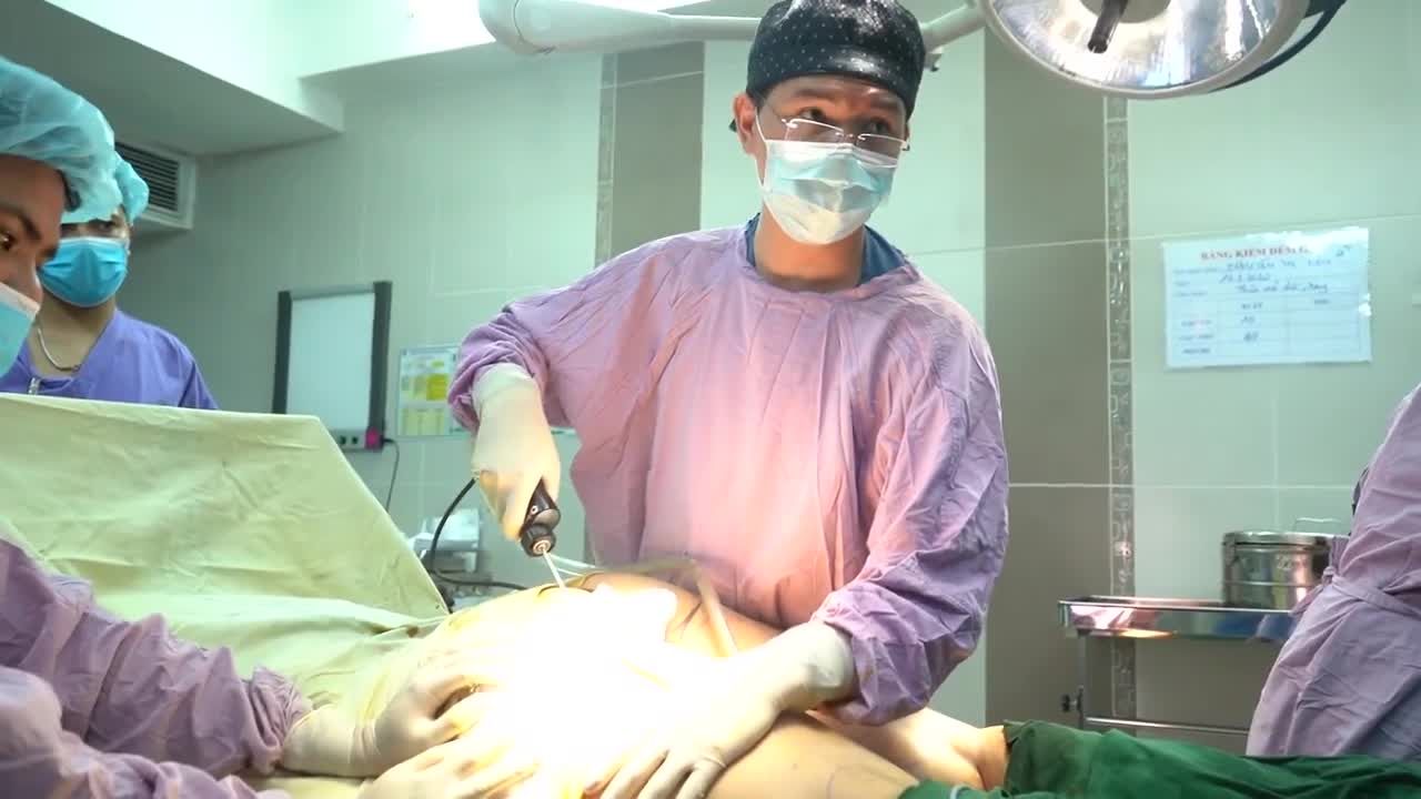 CA HÚT MỠ ĐÙI THỨ 5 TRONG NGÀY