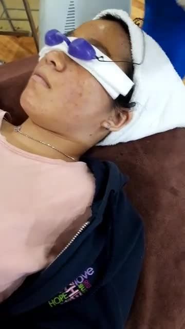 Chớp ưu đãi tuần vàng trị mụn chỉ từ 99K, chị khách hàng hạnh phúc với kết quả sau 2 buổi điều trị