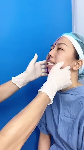 Ca chỉnh hình hàm mặt thứ 10 trong ngày