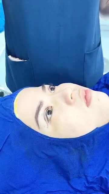 Cắt Mí HÀN QUỐC cực đẹp, chỉ với 30’ đã có ngay một đôi mắt ĐẸP LONG LANH