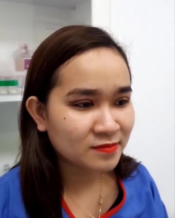 Chị gái vừa mới CẮT MÍ được 5 phút. Giờ vẫn sưng, sau 2 tuần là ổn thôi nhé cả nhà.