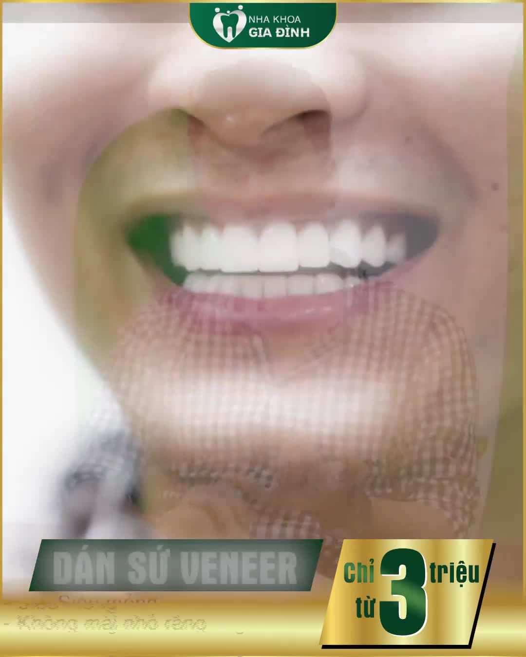 CHỌN THẨM MỸ RĂNG - CÁCH ĐỂ SAO VIỆT TỰ TIN, TOẢ SÁNG