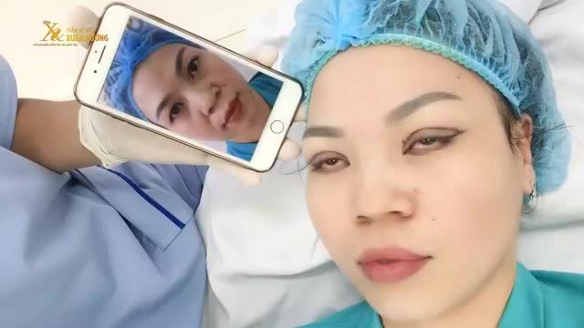KHUÔN MẮT ĐỀU ĐẸP, TRẺ TRUNG NGAY KHI VỪA CẮT MÍ XONG
