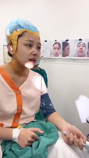 MŨI CẤU TRÚC SURGIFORM PHONG THỦY