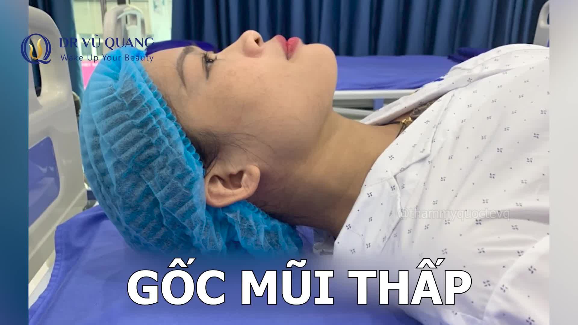 NÂNG MŨI DR VŨ QUANG CÓ GÌ KHÁC BIỆT ?