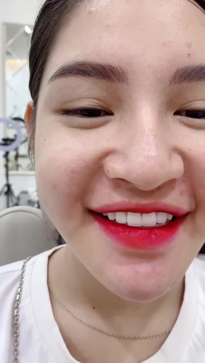 ️ RĂNG SỨ CÔNG NGHỆ ĐỨC - BỀN ĐẸP 40 NĂM
