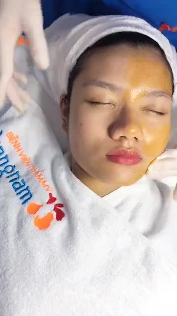 Cơ hội TRỊ MỤN 99K vẫn còn!