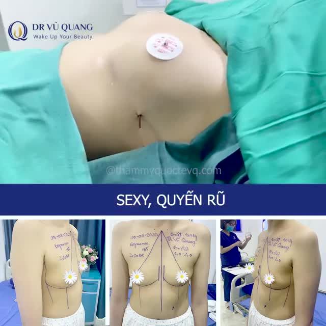 NÂNG V1 DR VŨ QUANG - ĐẸP NGAY SAU LÀM