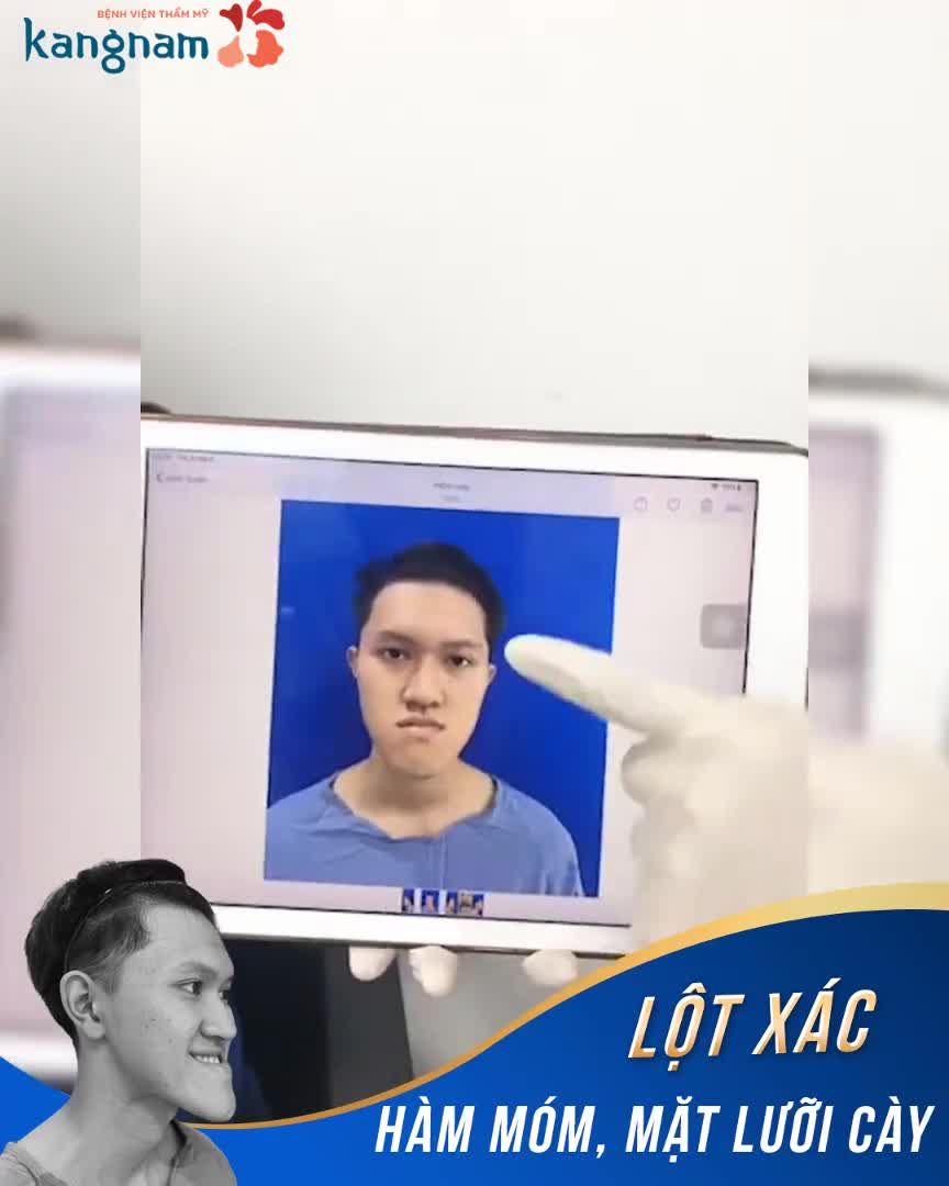 Dáng cằm "siêu dài" vô cùng đặc biệt