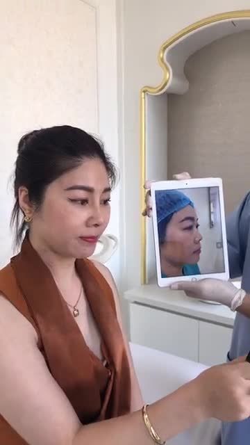 KHÁCH HÀNG ĐẾN XUÂN HƯƠNG RÚT CHỈ NÂNG MŨI SAU 10 NGÀY