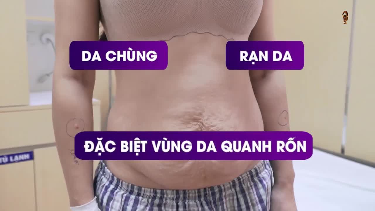 Những yếu tố quan trọng quyết định đến kết quả của 1 ca tạo hình V2 !