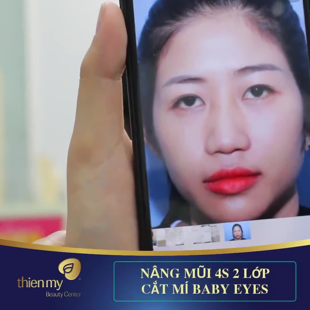 DÁNG MŨI S-LINE - MÍ BABY EYES