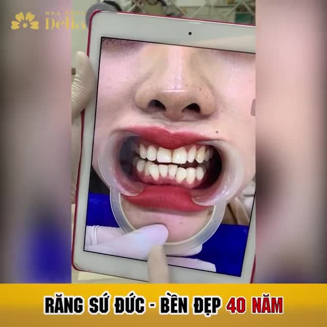 Đến Delia trải nghiệm công nghệ Đức - Chi phí Việt
