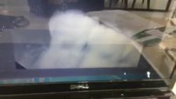 Nhổ răng khôn số 28 sâu viêm tuỷ gây đau cho bạn Tùng tại Nha Khoa Thuỳ Anh.