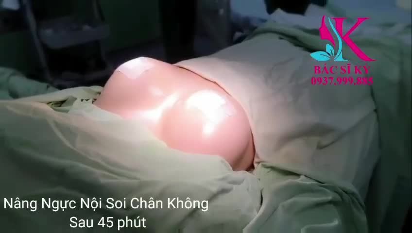 “ Lép phẳng”, “ Lép xệ” không còn là nổi buồn tự ti của các Chị Em nữa