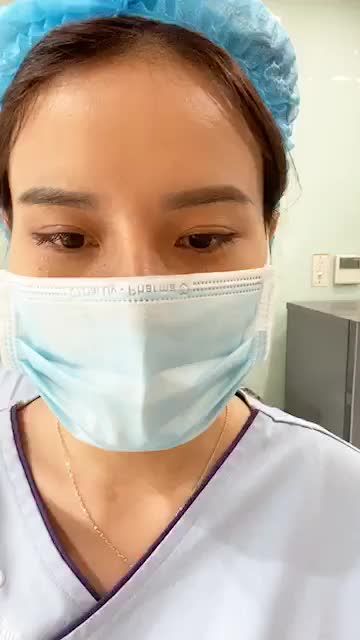 Nâng mũi Sline cải thiện tình trạng gốc mũi thấp, đầu mũi hếch nhiều.