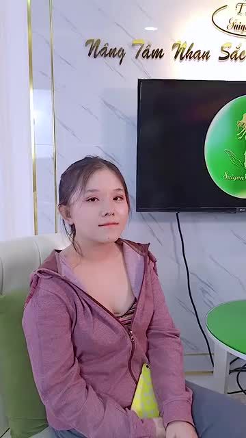 1 THÁNG SAU KHI LÀM DỊCH VỤ NÂNG MŨI CẤU TRÚC FASCIA + BẤM Mí