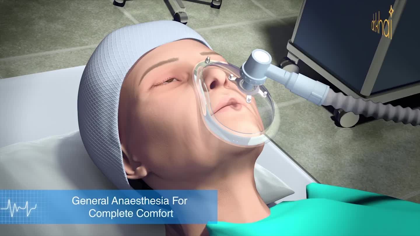 CĂNG DA MẶT NỘI SOI - HỒI SINH TUỔI ĐÔI MƯƠI