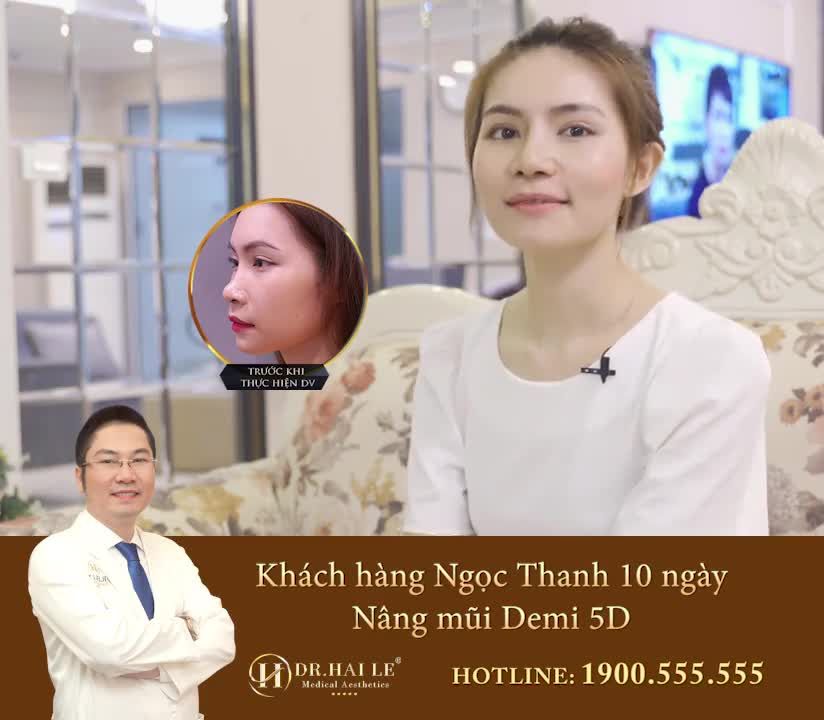 NÂNG TẦM NHAN SẮC VỚI DÁNG MŨI DEMI 5D SAU 10 NGÀY.!!