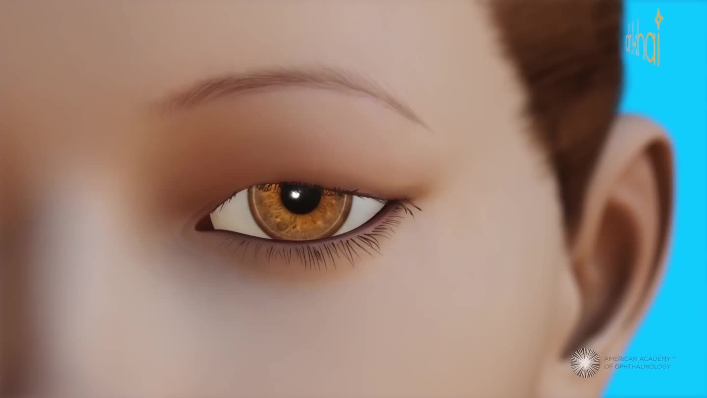 HIỂU KỸ THUẬT CẮT MÍ TRONG 10S tại trung tâm bác sĩ Đỗ Quang Khải