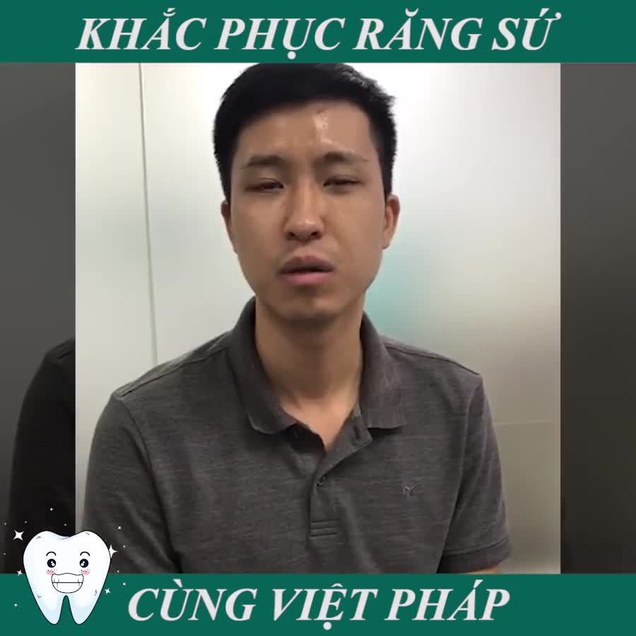PHỤC HÌNH RĂNG SỨ - HOÀN THIỆN NỤ CƯỜI