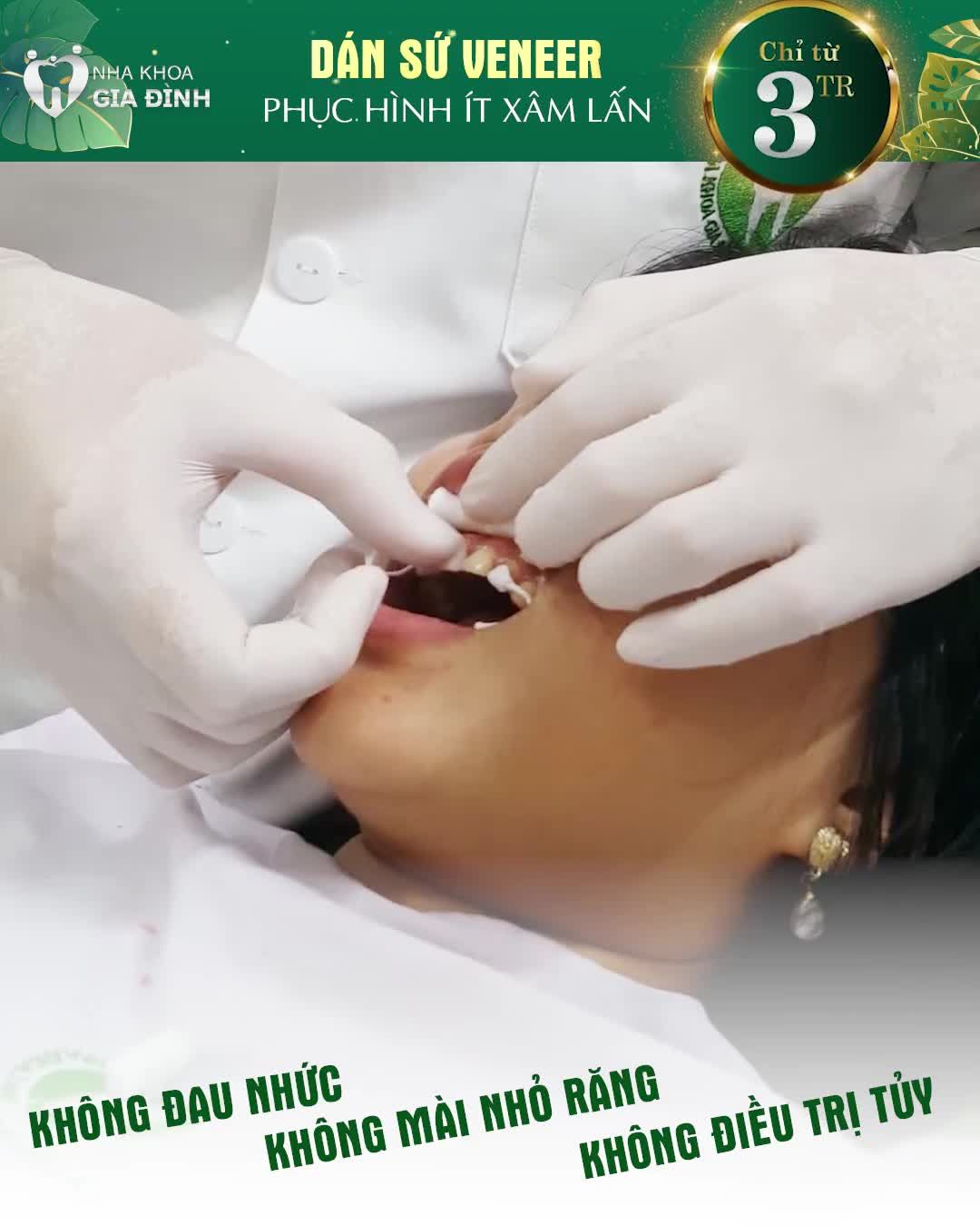 HÀI LÒNG TUYỆT ĐỐI SAU KHI SỞ HỮU NỤ CƯỜI MỚI