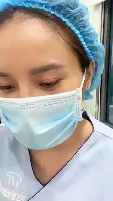 Cận cảnh kết quả sau nâng mũi Sline ngay trên bàn tiểu phẫu, không sưng, không tím, không đau chút nào!