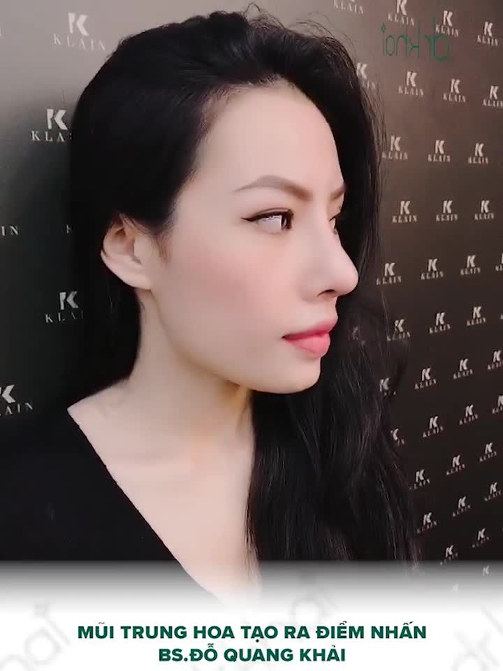 Gọi ngay hotline 0923999229 ngay hôm nay, để được nâng mũi cấu trúc chỉ với 30 triệu đồng.