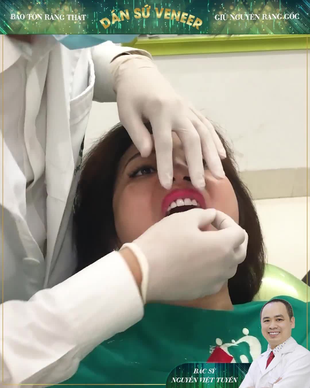 DÁN SỨ VENEER: KHÔNG MÀI NHỎ RĂNG - BẢO TỒN RĂNG THẬT