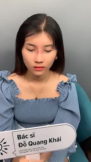 Tuần cuối nhận Ưu Đãi Nâng mũi 30 triệu. Gọi ngay hotline: 0923999229